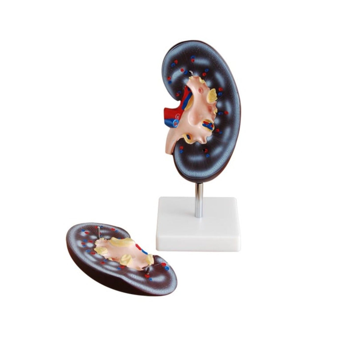 Modelo de Riñón (2 partes)