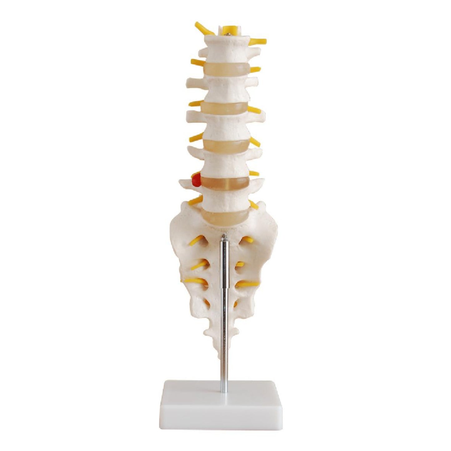 Life-Size Lumbar Vertebrae with Sacrum & Coccyx & Herniated
