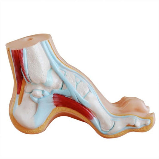 Arched Foot