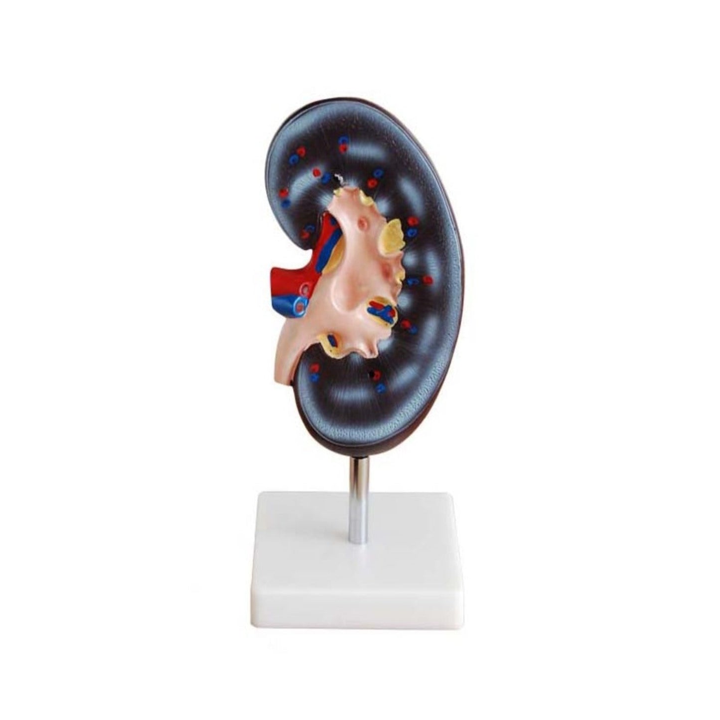 Kidney Model (1 Part)