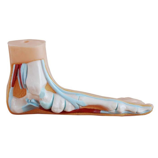 Flat Foot