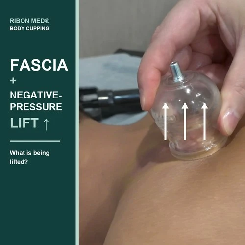 Fascia And Negative-Pressure Lift: What Is Actually Being Lifted?
